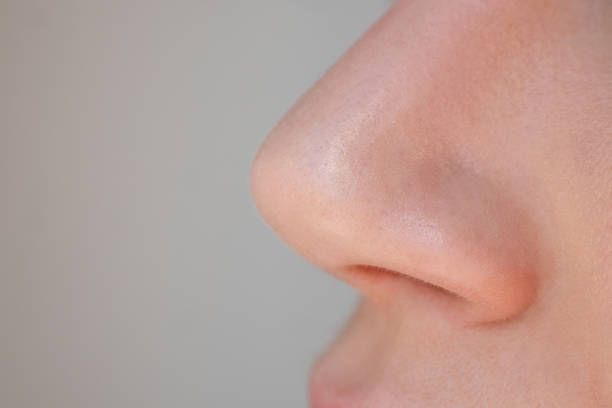 كيف أتعامل مع التورم والكدمات بعد تجميل الأنف؟